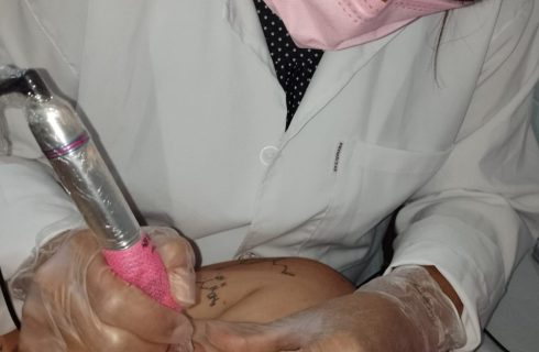 ONG Todo Dia é Rosa devolve a autoestima a mulheres e homens vítimas de câncer